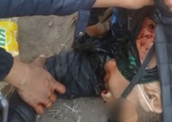 Esa herida es de bala, obvio no es honda