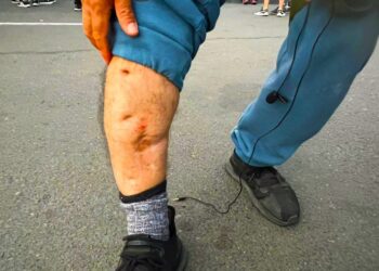 Policía Dispara a Periodista Después de Someter Brutalmente a un Adolescente (Vídeo)