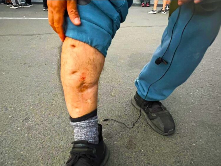 Policía Dispara a Periodista Después de Someter Brutalmente a un Adolescente (Vídeo)