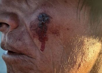 Perú: alto a la represión de la dictadura- MMG LIMITED al campesinado de Pumamarca en Las Bambas