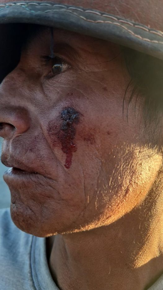 Perú: alto a la represión de la dictadura- MMG LIMITED al campesinado de Pumamarca en Las Bambas